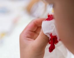 Как быстро остановить кровь из носа? 6 простых приёмов
