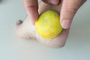 Как избавиться от трещин на пятках с помощью лимона?