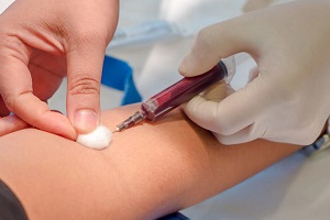 Как правильно сдать анализ крови на холестерин? 6 основных правил